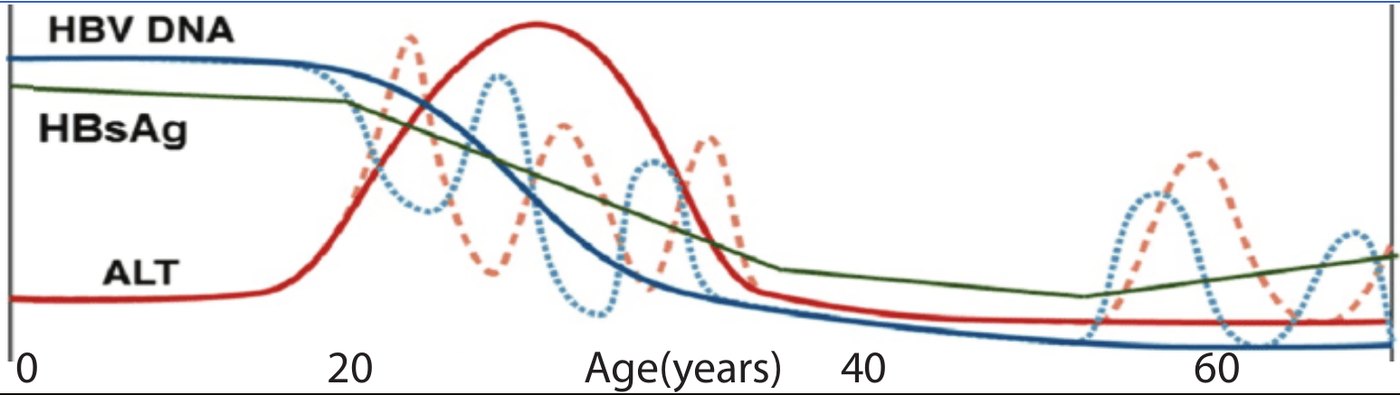 Natural history graph of hepatitis B markers including HBV DNA, HBsAg and ALT